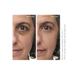 before and after Enlighten Under Eye Concelaer van Jane Iredale bij Lisa Bosmans Skincare